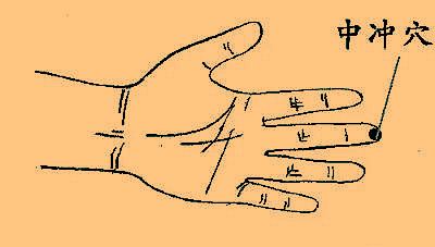 “晕车”怎么办 不妨试试按压这六个穴位