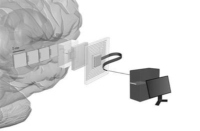 100万个神经元将与计算机直接对话