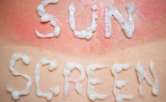 夏季晒伤不害怕 2种偏方去痛又消痕 夏季晒伤不害怕 2种偏方去痛又消痕