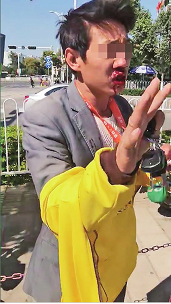 外卖小哥着急送餐乱停车 鼻骨被打折
