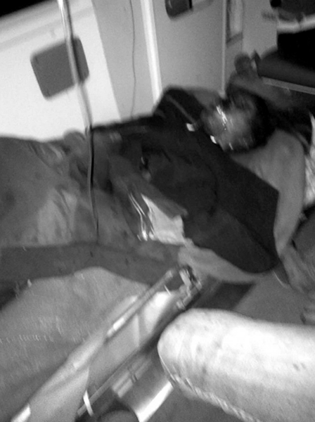 被烧伤的杨高飞 被烧伤的杨高飞