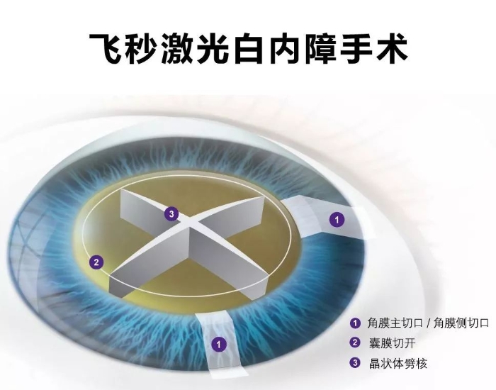 飞秒 资讯频道