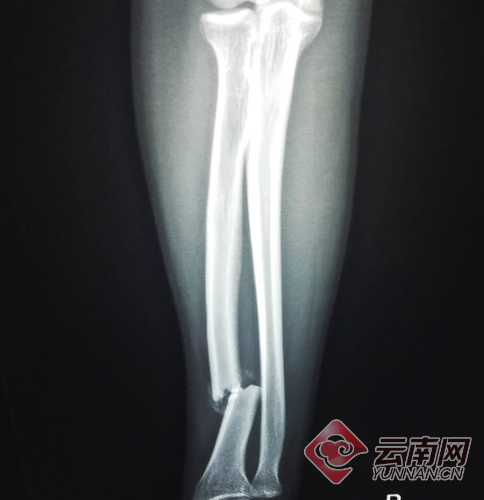 00300095387_0e6e26dd 00300095387_0e6e26dd