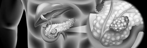 蛋白质组学精准打击“癌症之王”