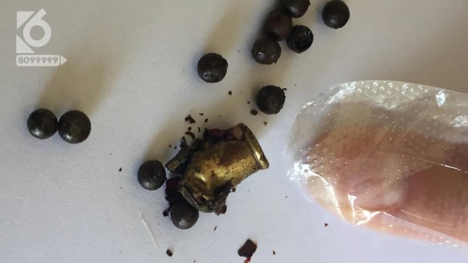 男子脸部被射15.5颗钢珠，竟说是“自己走火”？