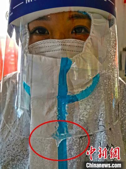 医护人员长时间坚守在凛冽寒风中,呼出的气息在隔离面罩上结成了冰霜。图片由陆军军医大学士官学校附属医院提供 医护人员长时间坚守在凛冽寒风中,呼出的气息在隔离面罩上结成了冰霜。图片由陆军军医大学士官学校附属医院提供