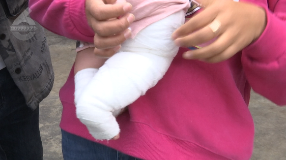 母婴店洗澡,8月婴儿被烫成二度烧伤