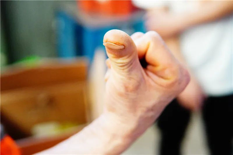 验果师邵一超多年验果留下的老茧.JPG 图片