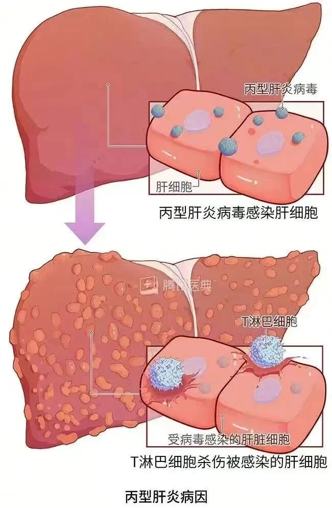 图片 1 图片 1